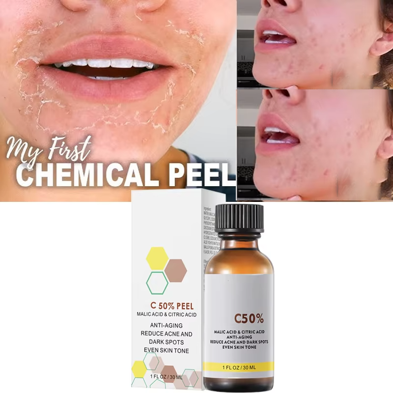Salicylic Acid Cleanser - Yüz Yüz Peelingi İçin Malik Asit