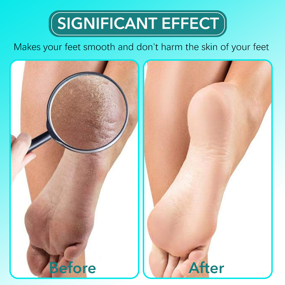 2 adet/takım cam ayak törpüsü  - Skincare Ingredients Checker incelemesi ve fiyatı