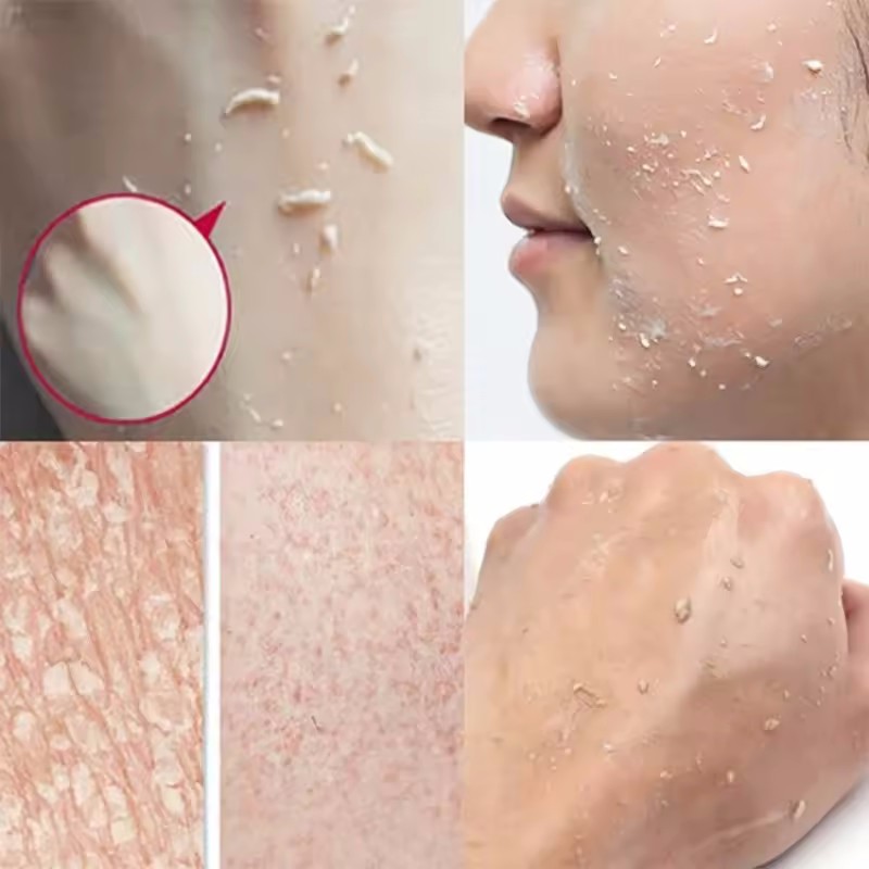 Turuncu Peeling Soyma Jeli Yüz - Ceramide Moisturizer incelemesi ve fiyatı