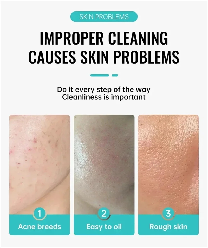 Salisilik Asit Sivilce Tedavis - Salicylic Acid Cleanser incelemesi ve fiyatı