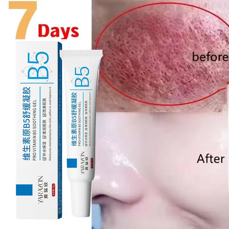 Yüz Kızarıklığı Onarıcı Krem H - Ceramide Moisturizer incelemesi ve fiyatı