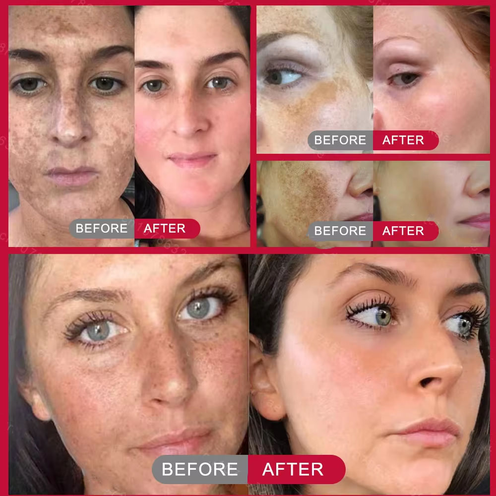 Güçlü Leke Giderici Beyazlatıc - Skincare Vitamin C incelemesi ve fiyatı