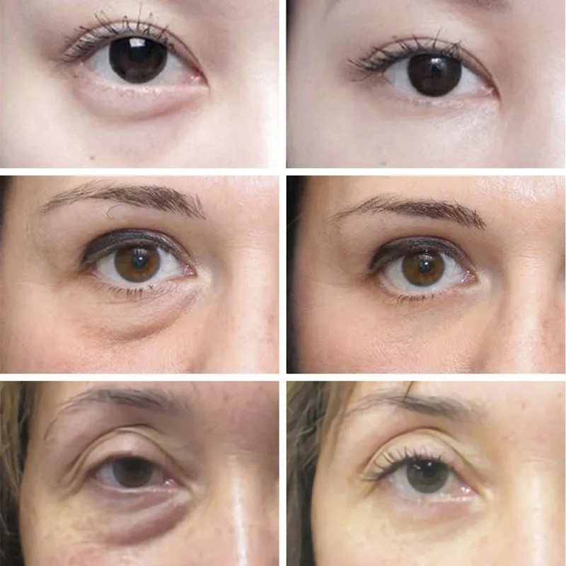 Kırışıklık Karşıtı Koyu Halka  - Skincare D'Alba incelemesi ve fiyatı